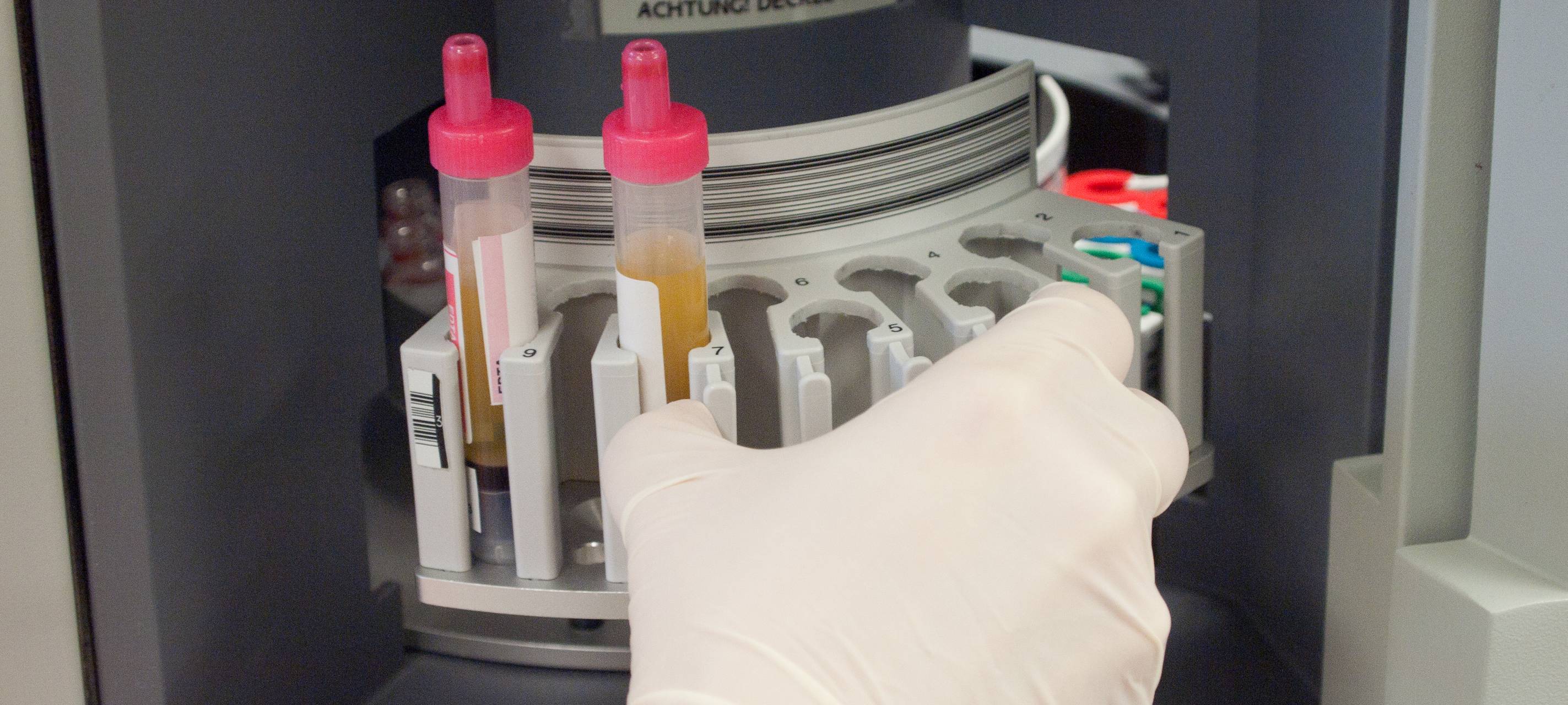 Hamm: Familienfeier sorgt für Corona-Fälle