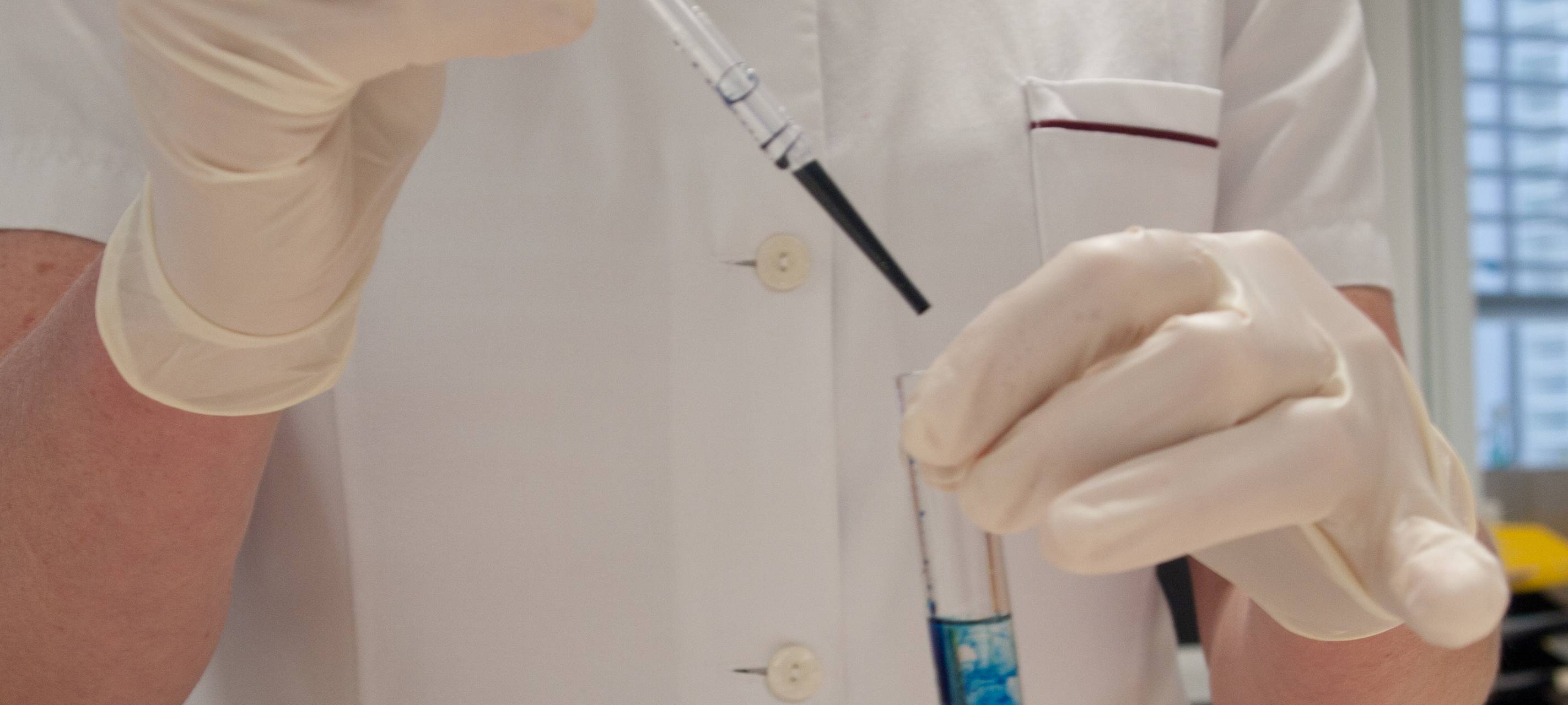 Dortmund ändert Bedingungen für Corona-Tests