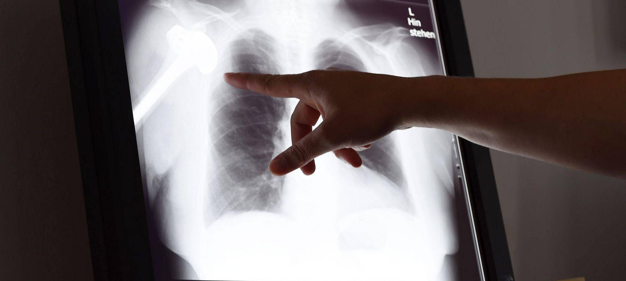Röntgenbild in Schlichtungsstelle für Arzthaftpflichtfragen