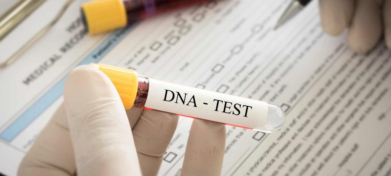 Werne: Gefundene Knochen gehören zu vermisstem 59-Jährigen